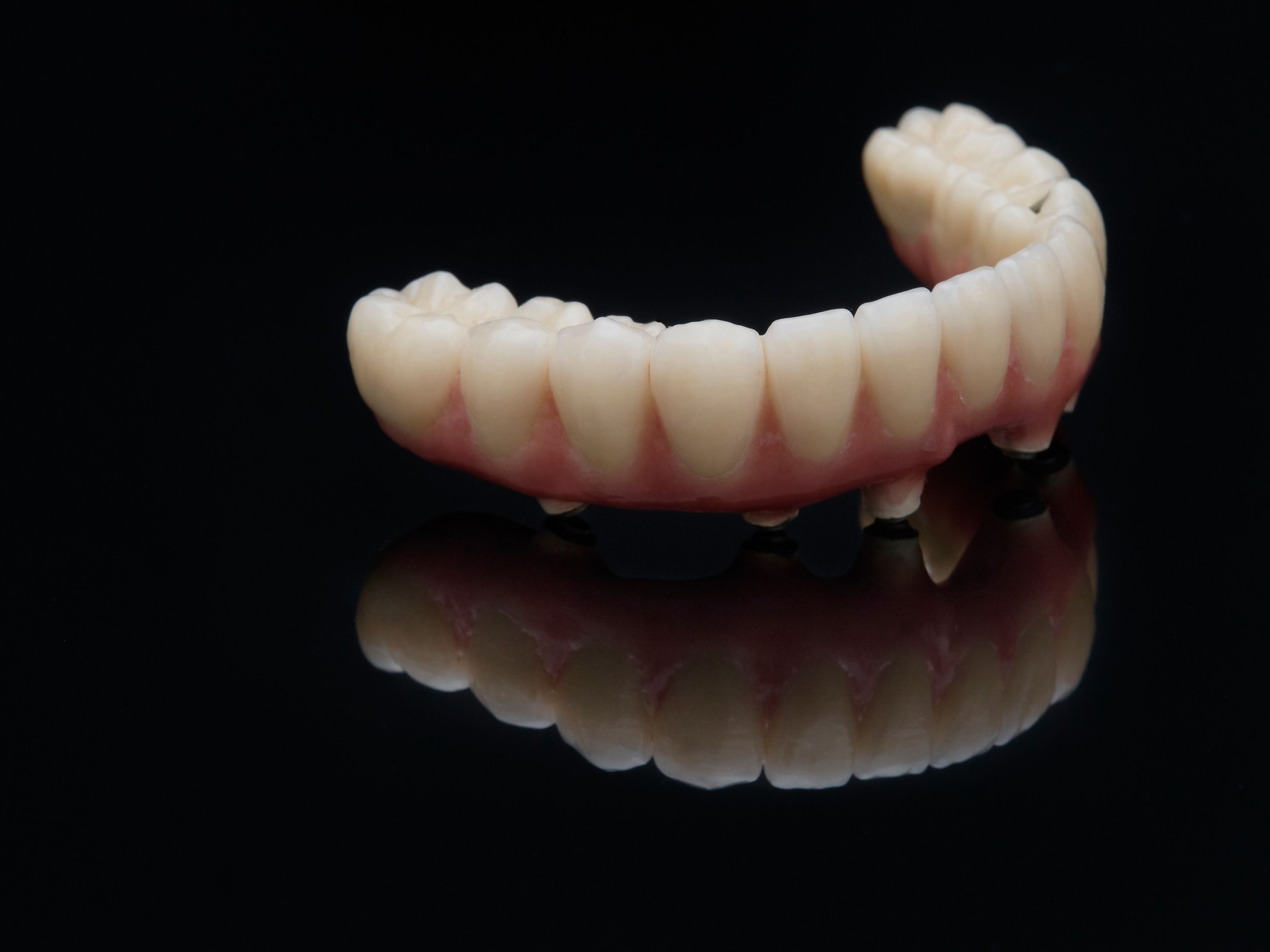 Complete lower prosthesis dental screwed over black glass