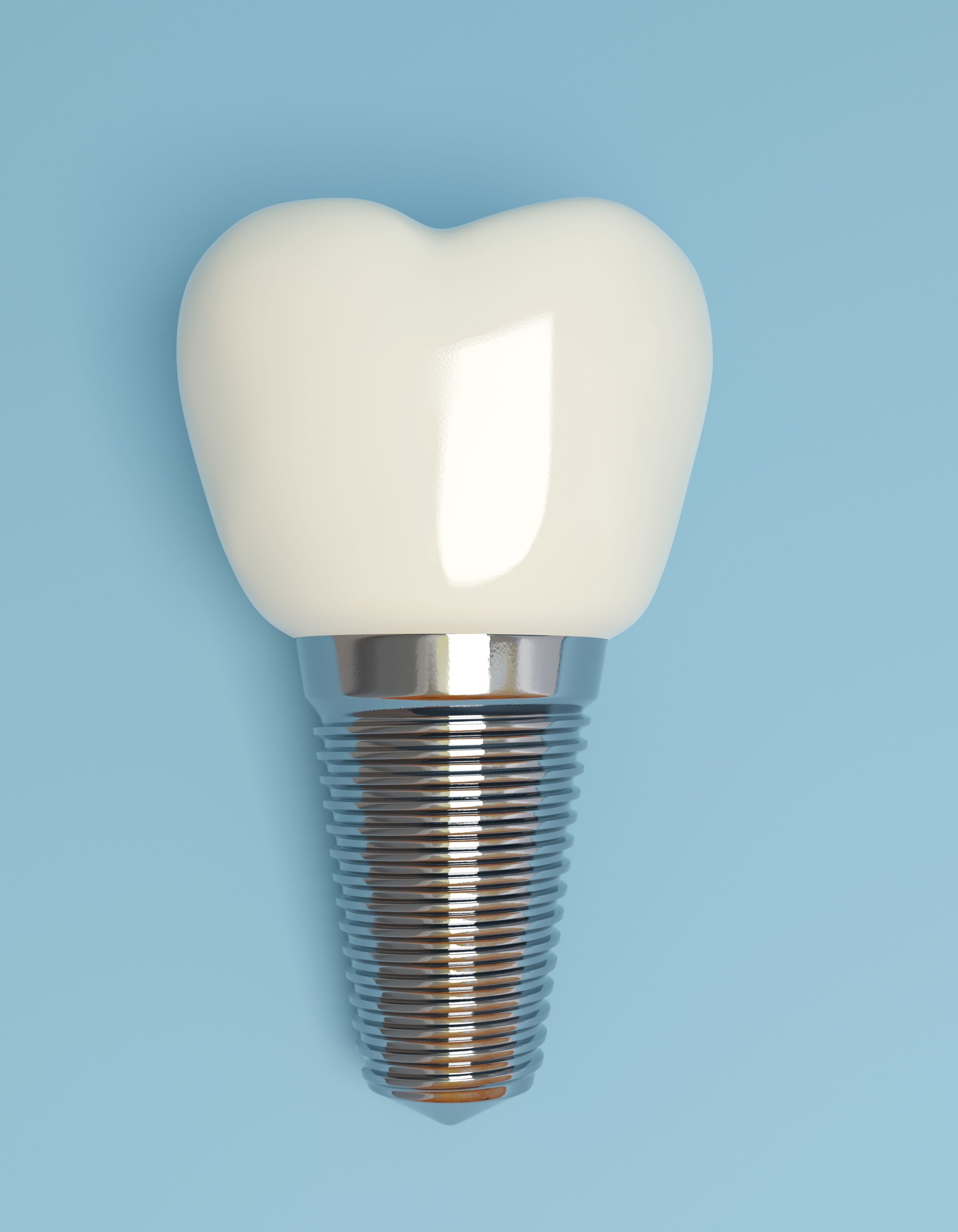 Tooth implant dental 3D illustration
