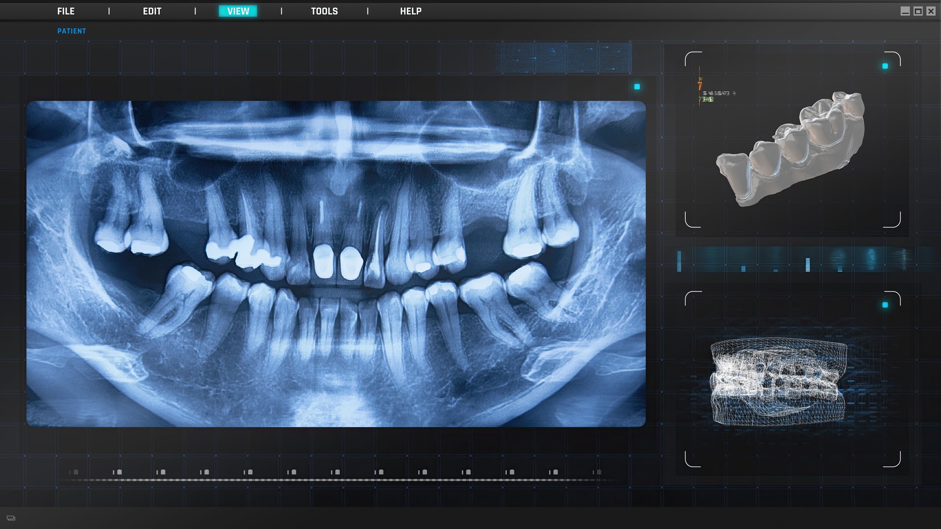 Dental tomography CT scan Xray screen monitor